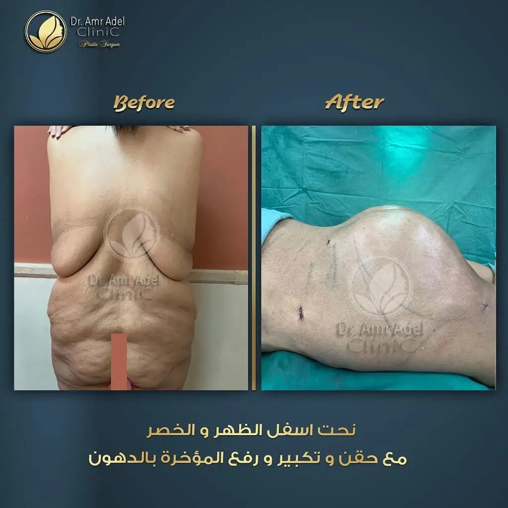 نحت-الظهر-الخصر