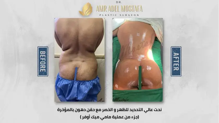 عملية-مامى-ميك-اوفر