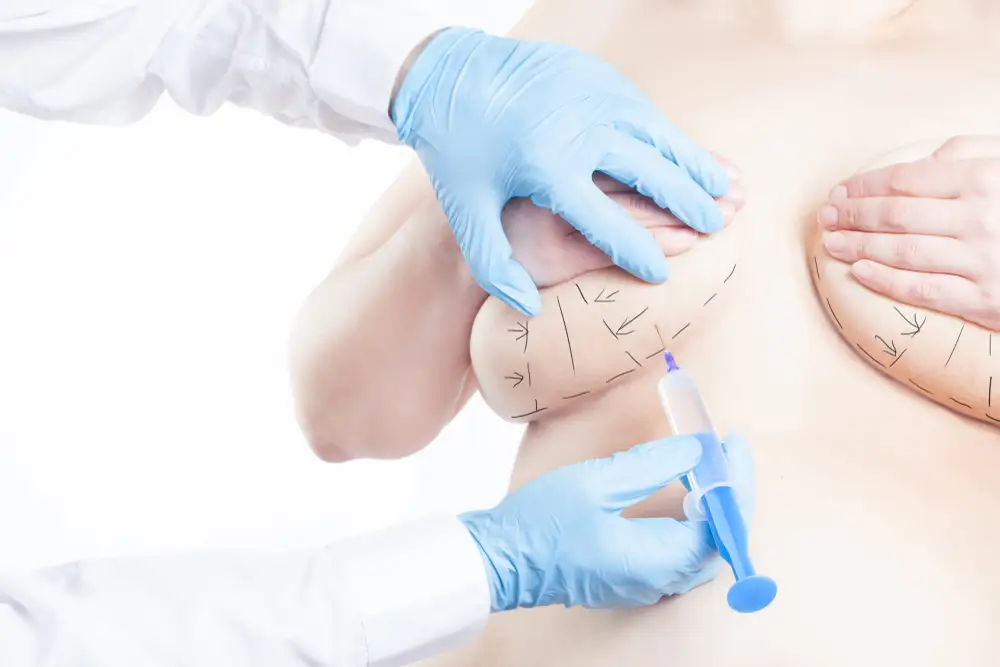 حقن-الثدى-بالدهون
