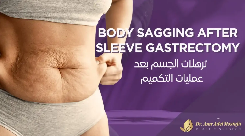 كيف شديت ترهل جسمى بعد التكميم وتجربتى مع علاج الترهل