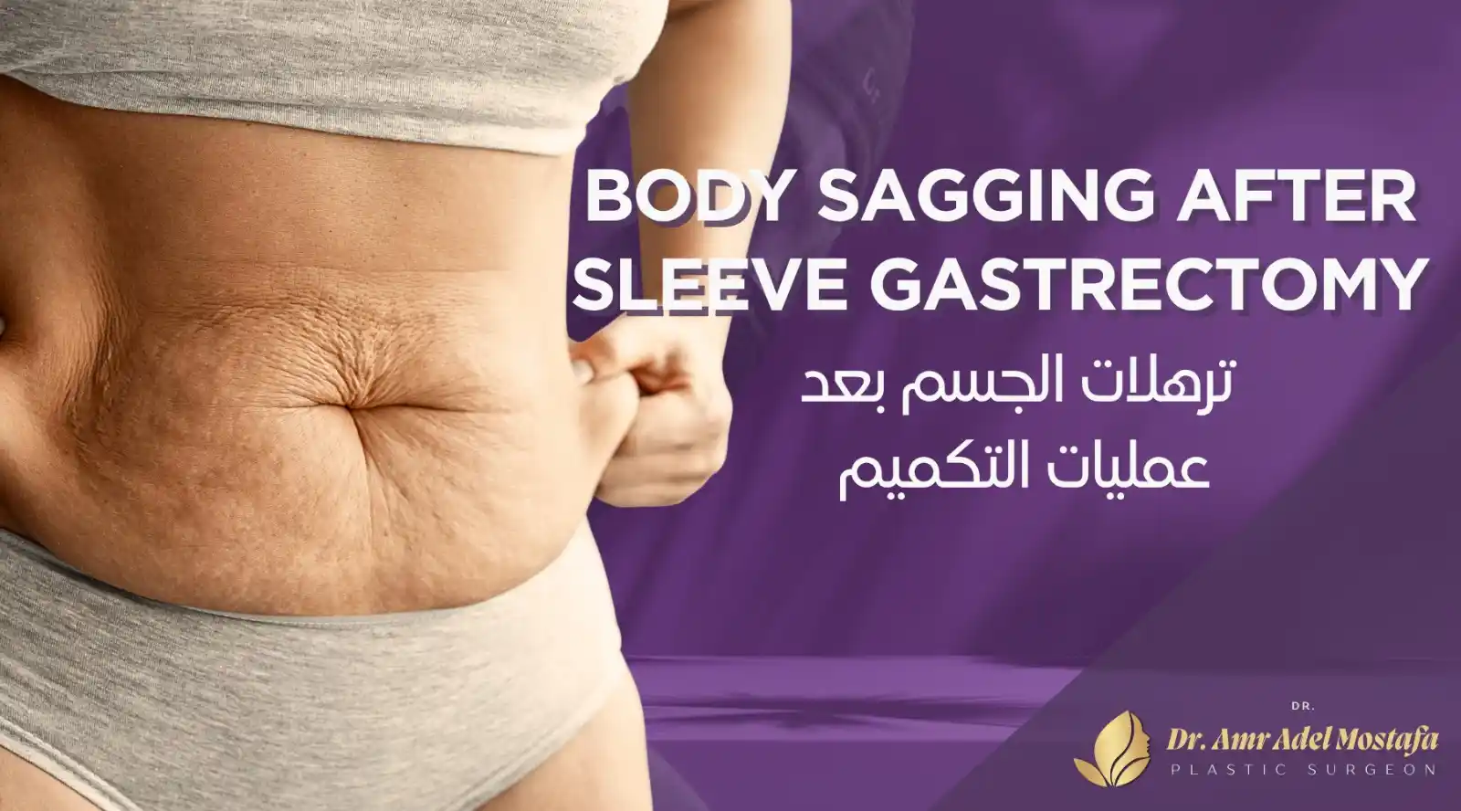 كيف شديت ترهل جسمى بعد التكميم وتجربتى مع علاج الترهل