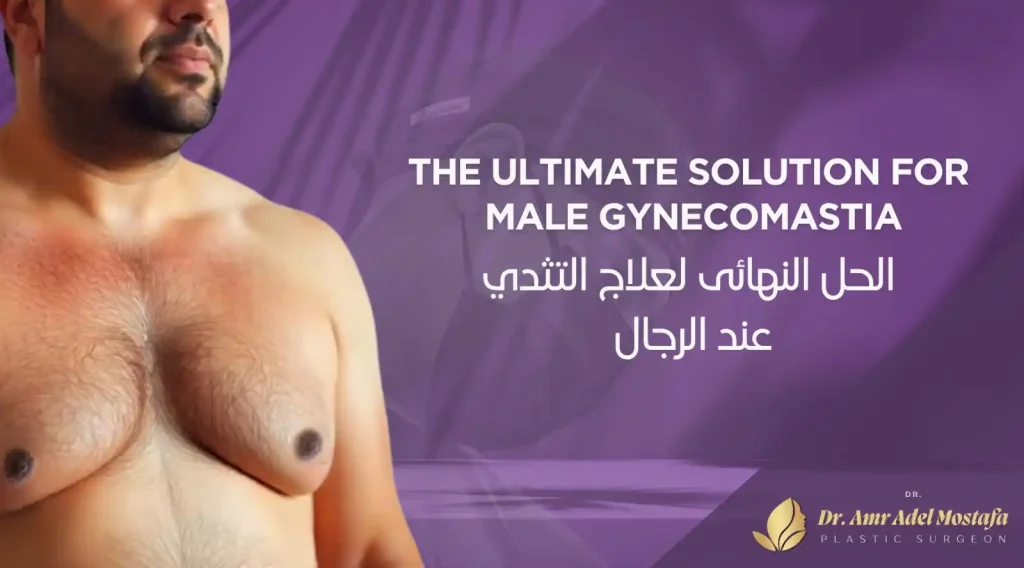 التثدي عند الرجال وطرق علاجه 2026| أفضل دكتور لعلاج التثدى