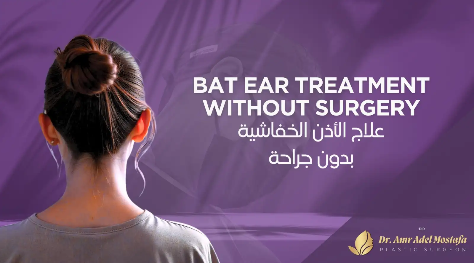 علاج الأذن الخفاشية بدون جراحة بنتائج مبهرة بأفضل سعر