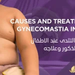 التثدي-عند-الأطفال