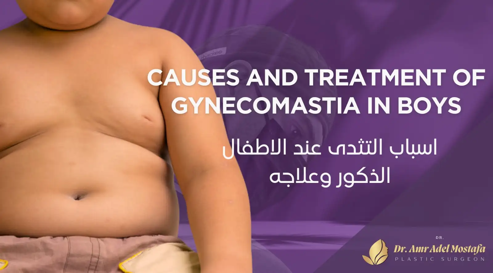 ماهى أهم أسباب التثدي عند الأطفال الذكور وكيف يتم علاجه ؟