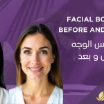 بوتكس-الوجه-قبل وبعد
