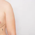 تثدى-الرجال