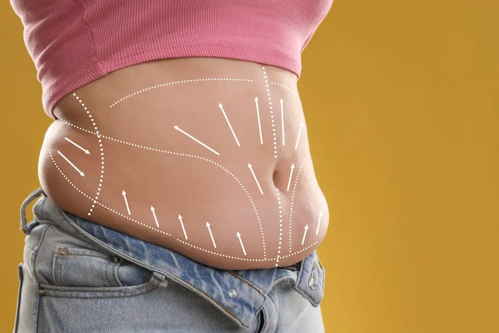 تجربتى-مع-شفط-الدهون