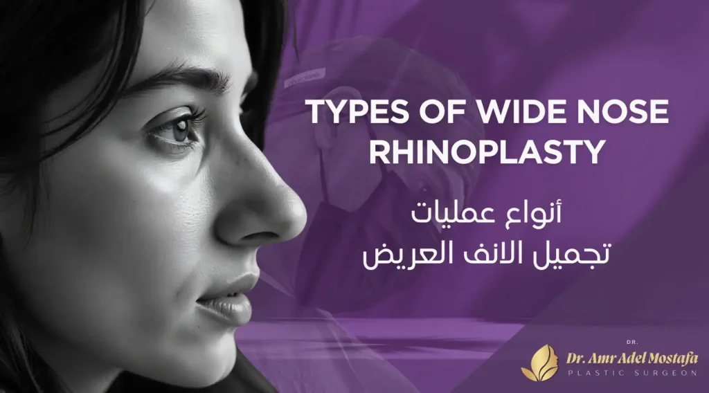 هل هناك عملية لتجميل الأنف العريض وماهو الإجراء الأنسب لك؟