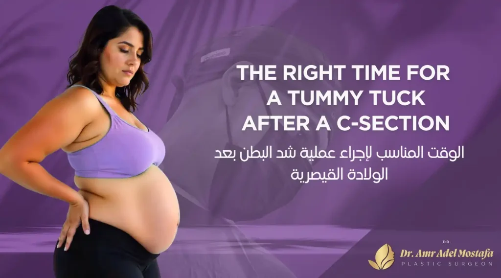 ما الفرق بين شد البطن بعد الولادة القيصرية والشد التقليدي ؟