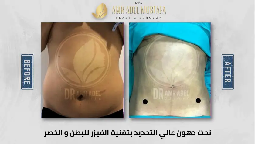 نحت-الظهر-والخصر