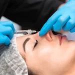 سعر-تجميل-الأنف-بالخيوط