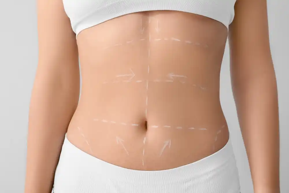 الجراحة-التجميلية-للجسم