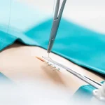 الخياطة -التجميلية