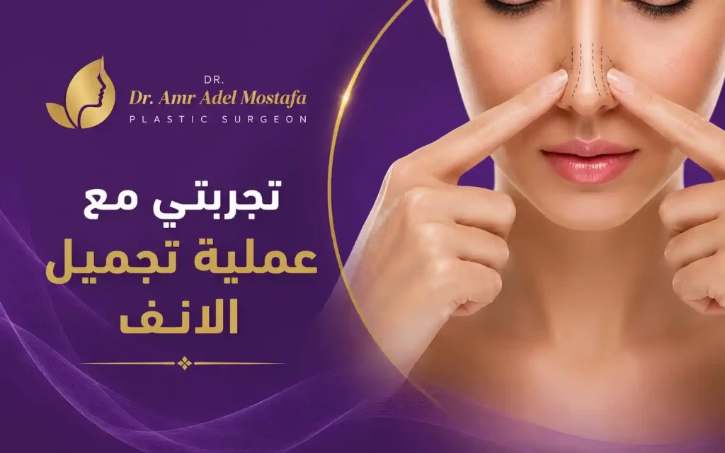 تجربتي مع عملية تجميل الانف 2026| اراء المرضى