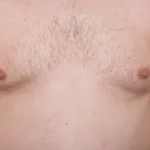 دكتور-لعلاج-التثدي