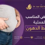 المريض-المناسب-لعملية-شفط-الدهون