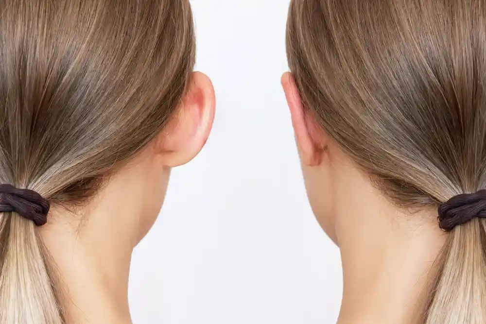 ماهو سعر عملية تجميل الاذن فى مصر 2026 ؟