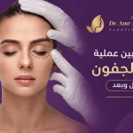 شد-الجفون-قبل-وبعد