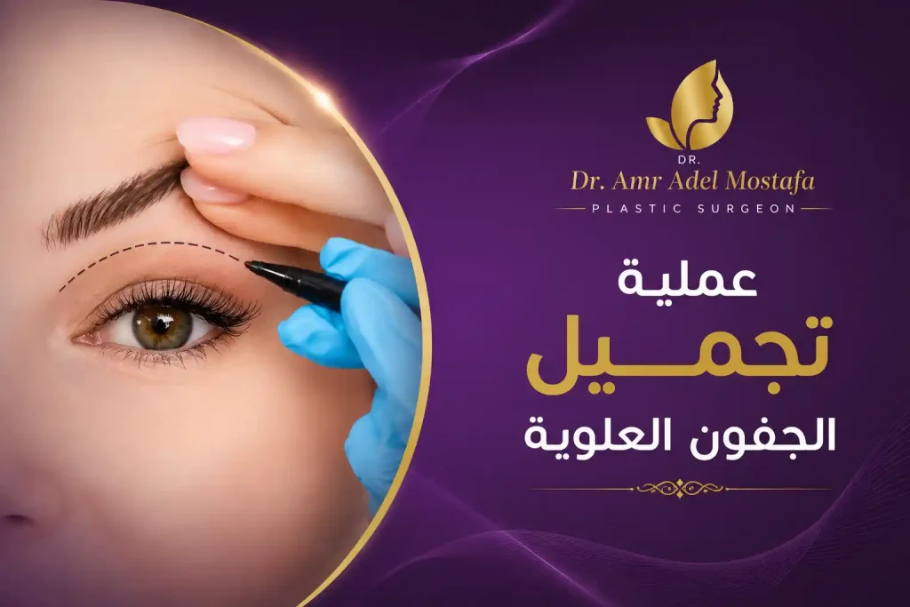 متى تظهر نتيجة عملية تجميل الجفون العلوية ؟