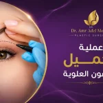 عملية-تجميل-الجفون-العلوية