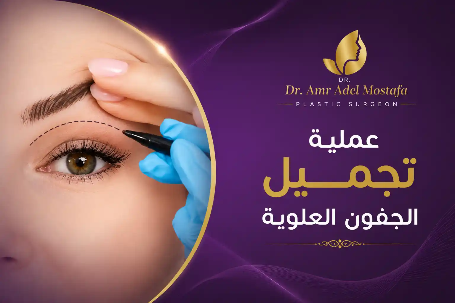 متى تظهر نتيجة عملية تجميل الجفون العلوية ؟