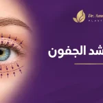 عملية-شد-الجفون