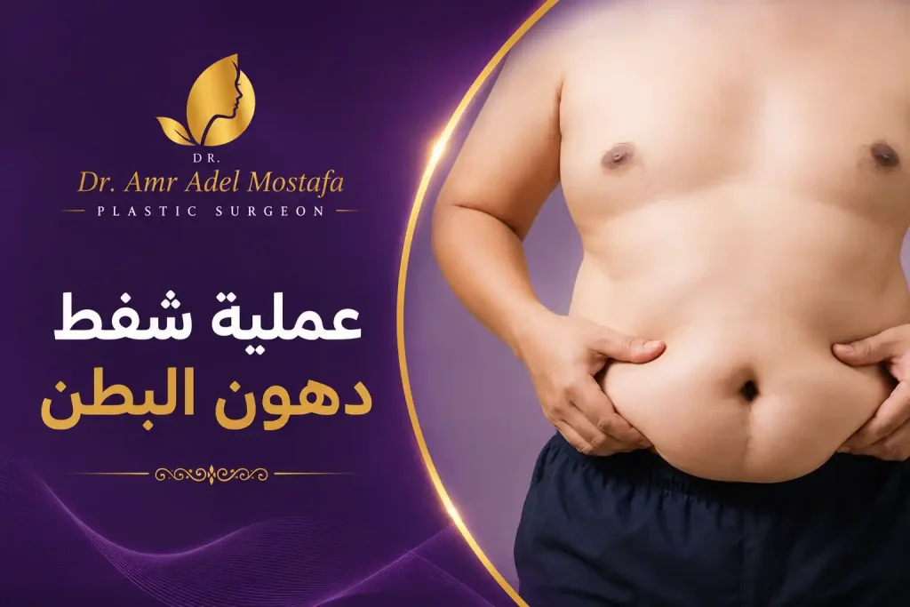 عملية شفط دهون البطن لجسم مشدود للرجال والنساء