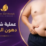 عملية-شفط-دهون-البطن