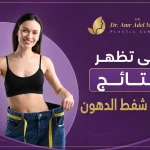 نتائج-عملية-شفط- الدهون