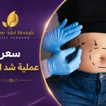 سعر-عملية-شد البطن