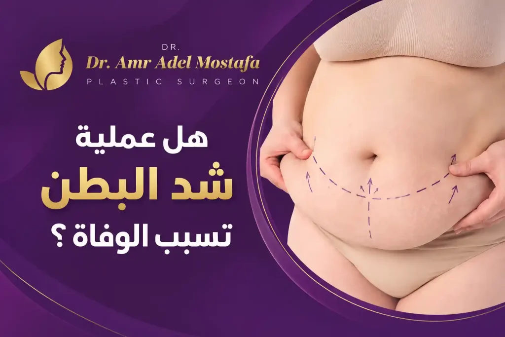هل عملية شد البطن تسبب الوفاة؟ وما مدى خطورتها؟