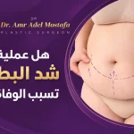 هل-عملية-شد-البطن-تسبب-الوفاة