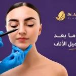 بعد-عملية-تجميل-الانف