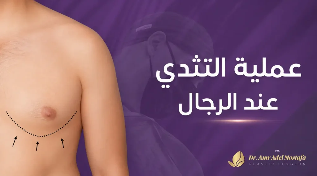 التثدي عند الرجال وأهم الاسئلة التى تبحث عنها قبل العملية