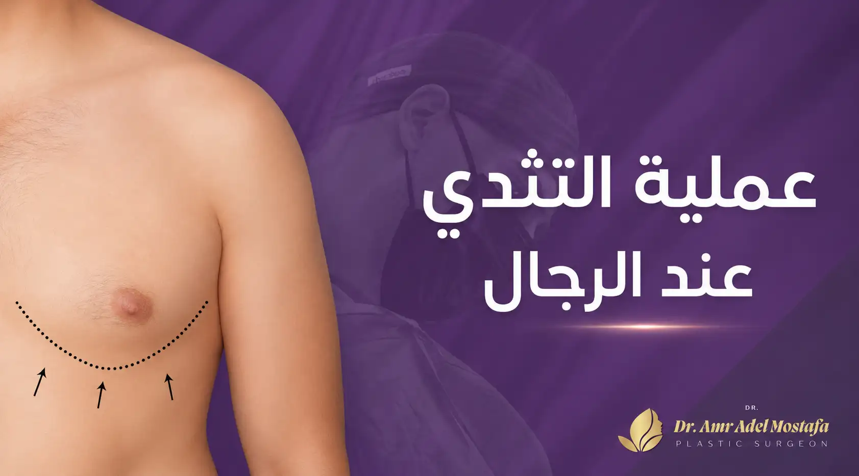 التثدي عند الرجال وأهم الاسئلة التى تبحث عنها قبل العملية