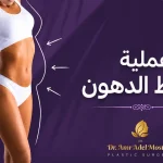 عملية -شفط-الدهون