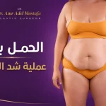 الحمل-بعد-شد-البطن