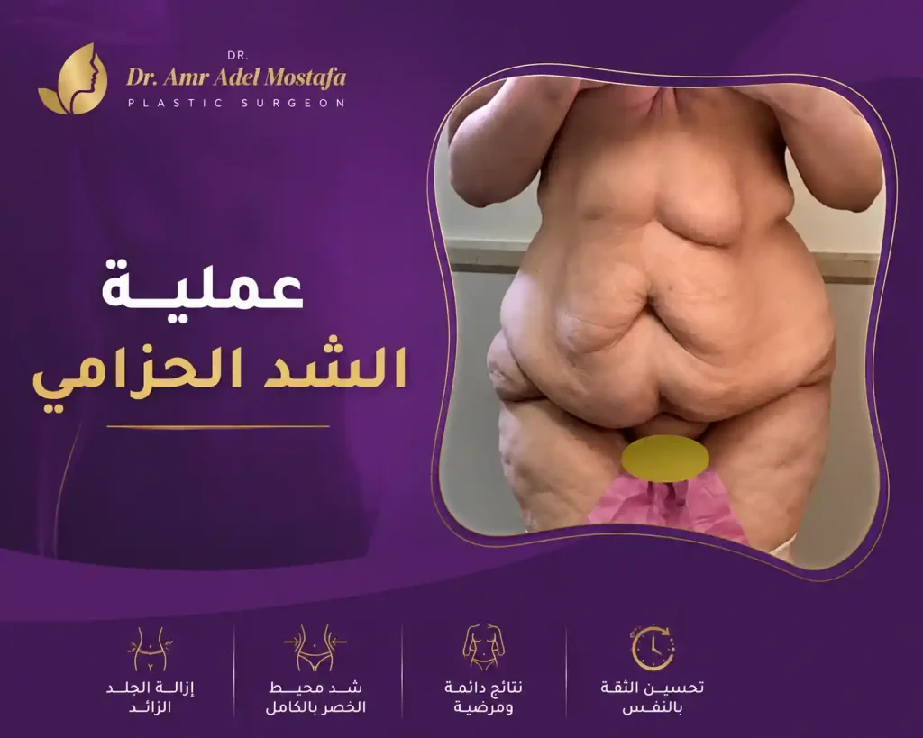 عملية الشد الحزامي 360: كل ما تريد معرفته عن العملية