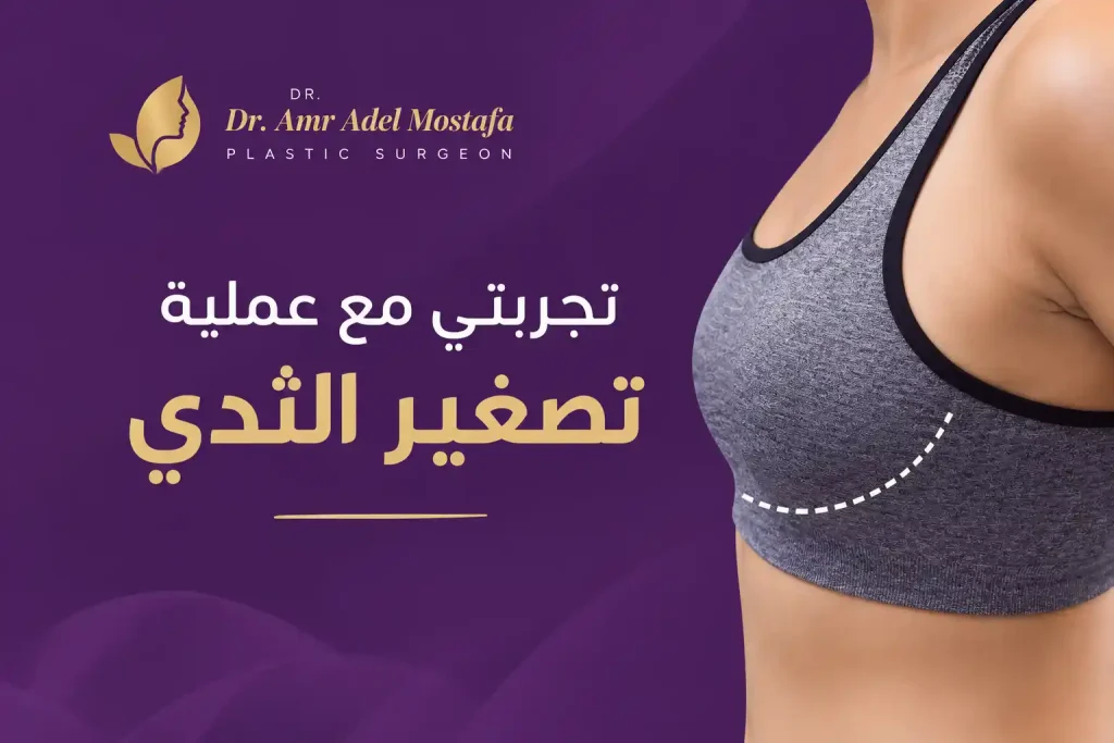 تجربتي مع عملية تصغير الثدي: التعافي والنتائج المتوقعة