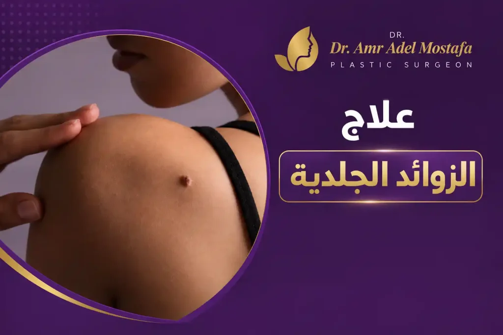 علاج الزوائد الجلدية: طرق فعالة لإزالتها بأمان