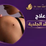 علاج-الزوائد-الجلديه