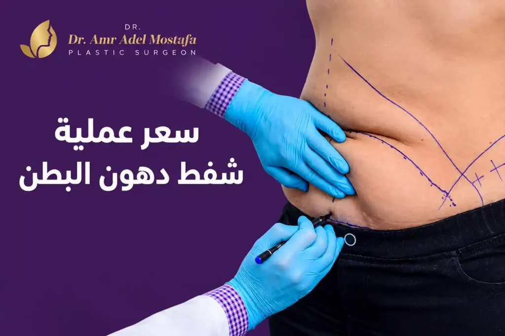 سعر عملية شفط دهون البطن والعوامل التي تحدد التكلفة